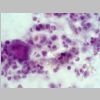 Medula osea HE 05.jpg